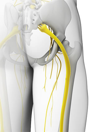 Chiropractic Treatment of Sciatica